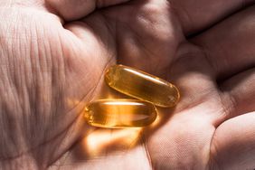 Two Yellow Colored Soft Capsules in Palm Close-up Directly Above Shot.