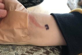 sepsis-vein vein infection sepsis woman health wellbeing