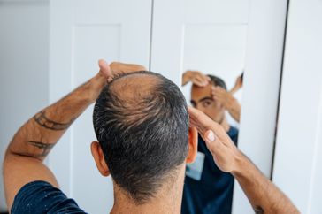 balding man looking into mirror