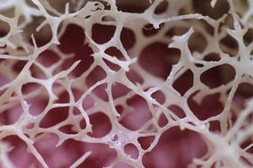 close-up photo of bone marrow
