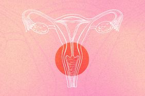 Cervical-Cancer-Symptoms-AdobeStock_231115375