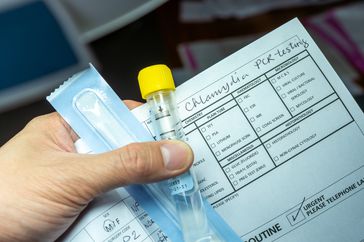 pcr test for chlamydia