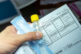 pcr test for chlamydia