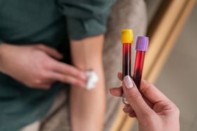person getting blood drawn for d-dimer test