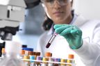 Lab professional with blood specimen for hemoglobin A1C test