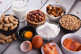 Most common food allergies