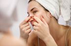 popping pimple on the the triangle of death (the nose)