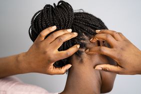 Black woman with braids in a bun holding her scalp