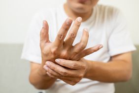 close up image of a man holding his twitching hand due to tardive dyskinesia