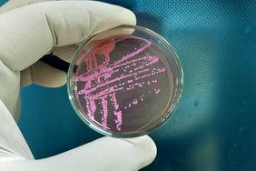 Stool Culture and Sensitive test on Salmonella Shigella (SS) Agar medium. Showing growth of E.Coli which consider as normal Flora.