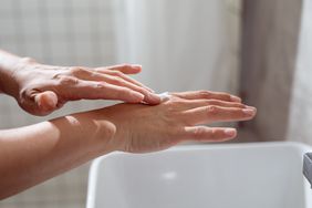 person with discoid eczema putting cream on their hands