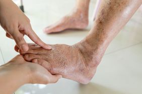 doctor examining the feet of an older adult with diabetes