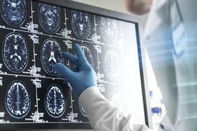 Doctor analyzing patients brain scan on screen
