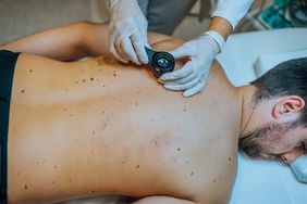 Dermatologist examining patient skin moles with dermoscope at clinic