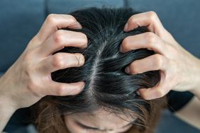 person scratching their scalp