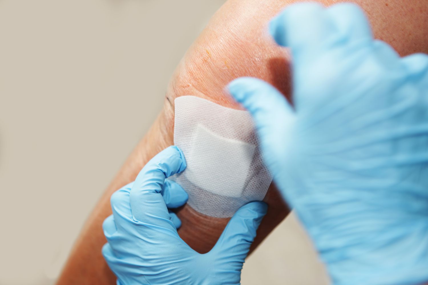Nurse is changing bandage to a patient