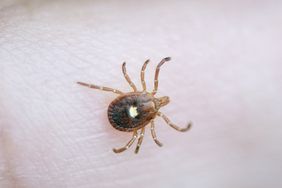 A lone star tick on someone's skin