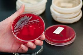 A hand holding a culture of Staphylococcus aureus on a jelly agar