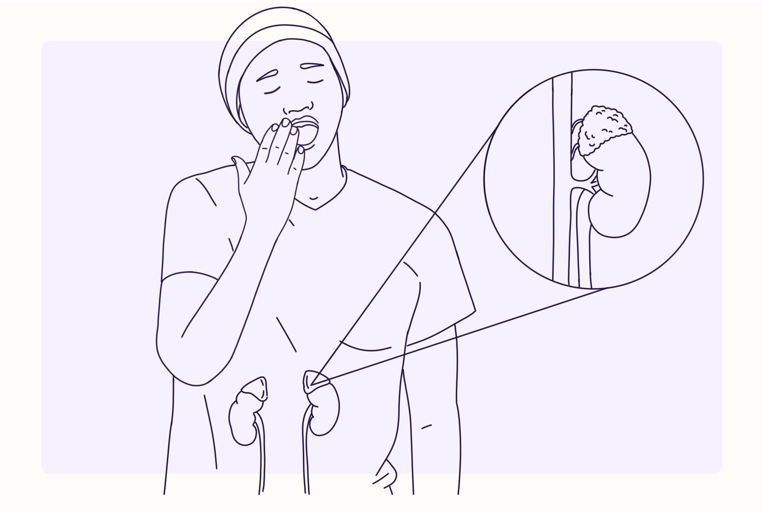 Health Overview Illustration - Addison's Disease