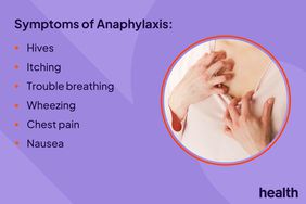 Symptoms of Anaphylaxis