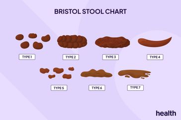 Bristol Stool Chart