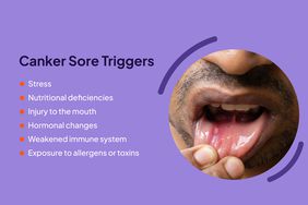 Canker Sore Compositr