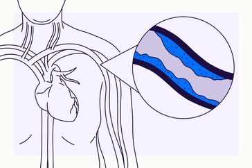 Overview Illustration - Cholesterol