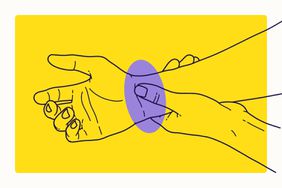 Illustration of Rheumatoid Arthritis