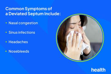 Common Symptoms of a Deviated Septum Include