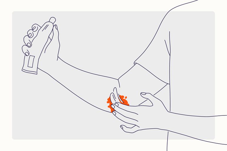 Health Overview Illustration - Eczema