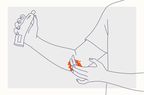 Health Overview Illustration - Eczema
