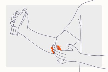 Health Overview Illustration - Eczema