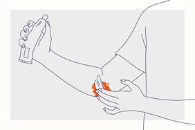 Health Overview Illustration - Eczema