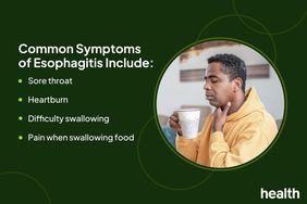 Health Photo Composite - Esophagitis