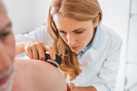 dermatologist diagnosing person with hidradenitis suppurativa
