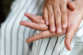 close up photo of right hand sitting atop left hand with ridges and discoloration on the nails