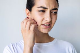 Woman scratch face with skin rash