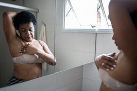 Woman looking at her skin in the mirror to check for lymphoma rash.