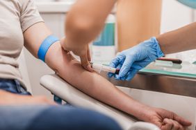 close-up blood sample