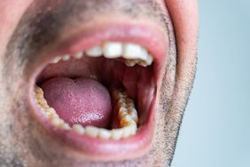 A close-up of a man's open mouth