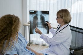person with mesothelioma seeing an x-ray of their lungs