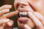 A woman applies a whitening tray to her upper teeth