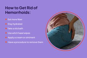 Photo Composite - Hemmorrhoids
