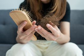 photo of person holding hair brush in right hand and hair loss in left hand