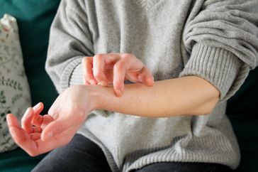 Itching, eczema, allergy