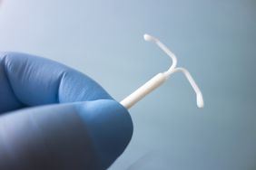 hormonal IUD