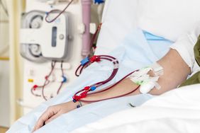 A person undergoes hemodialysis 