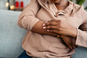Close-up of person scratching their arm.