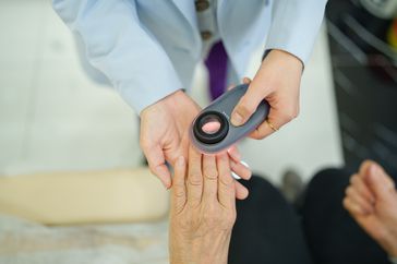 A dermatologist examines a person's nails with a special tool