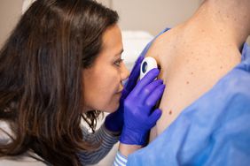 Dermatologist examining rash on patient's back